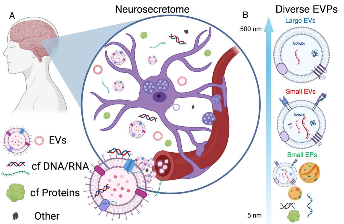 Biomarkeri ARN din sânge pot permite detectarea mai timpurie a bolii Alzheimer