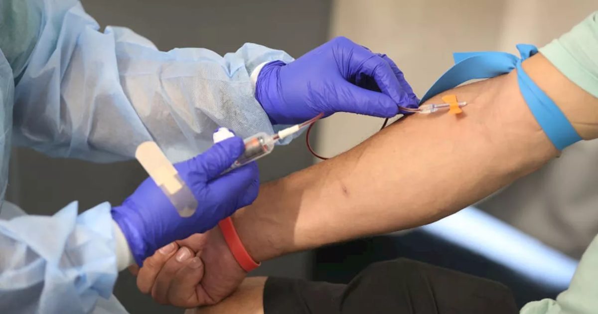 Test sanguin Stockholm3 superior testului PSA pentru detectarea cancerului de prostată agresiv