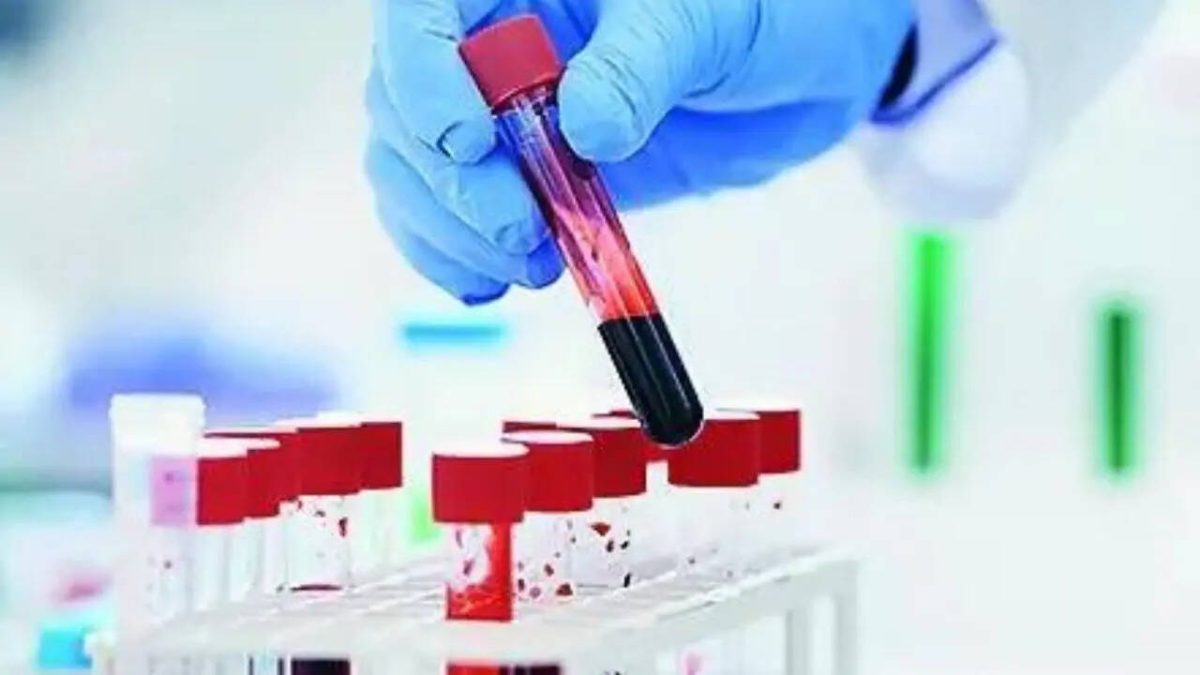 Blodprov kan förutsäga lungcancer upp till 5 år före diagnos