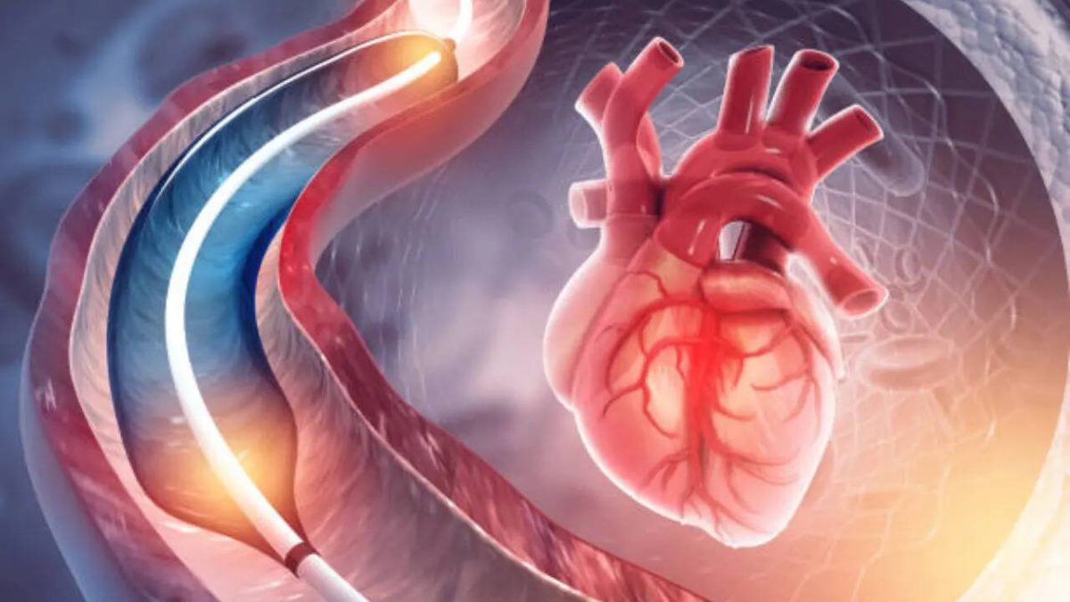 Doctorul demontează mitul cardiac: Angiografia este diagnostică, nu terapeutică