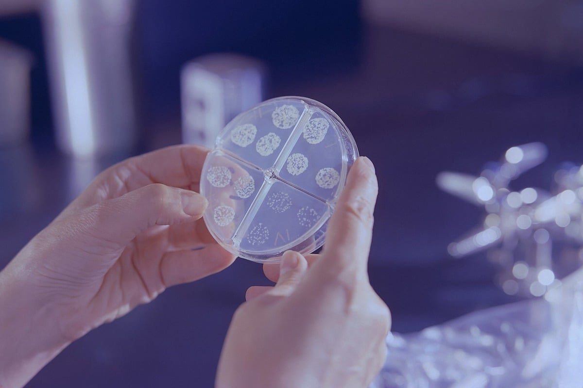 Drug-Resistant TB Exposure Alert: Campus and Public Transit Affected