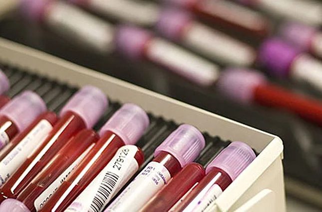 Poate managementul diabetului să încetinească Alzheimer-ul? Studiul urmărește un biomarker cheie